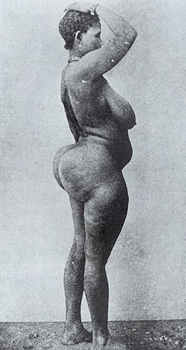 woman_with_steatopygia